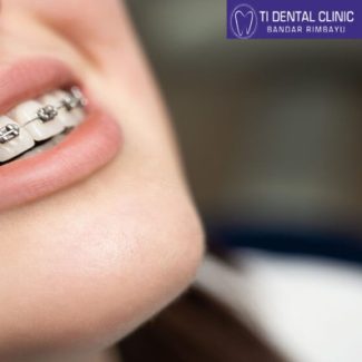 Group logo of Unveiling the World of Dental Implants (Tidental)